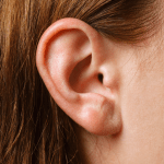 Completely in-the-canal - Hearing Aid